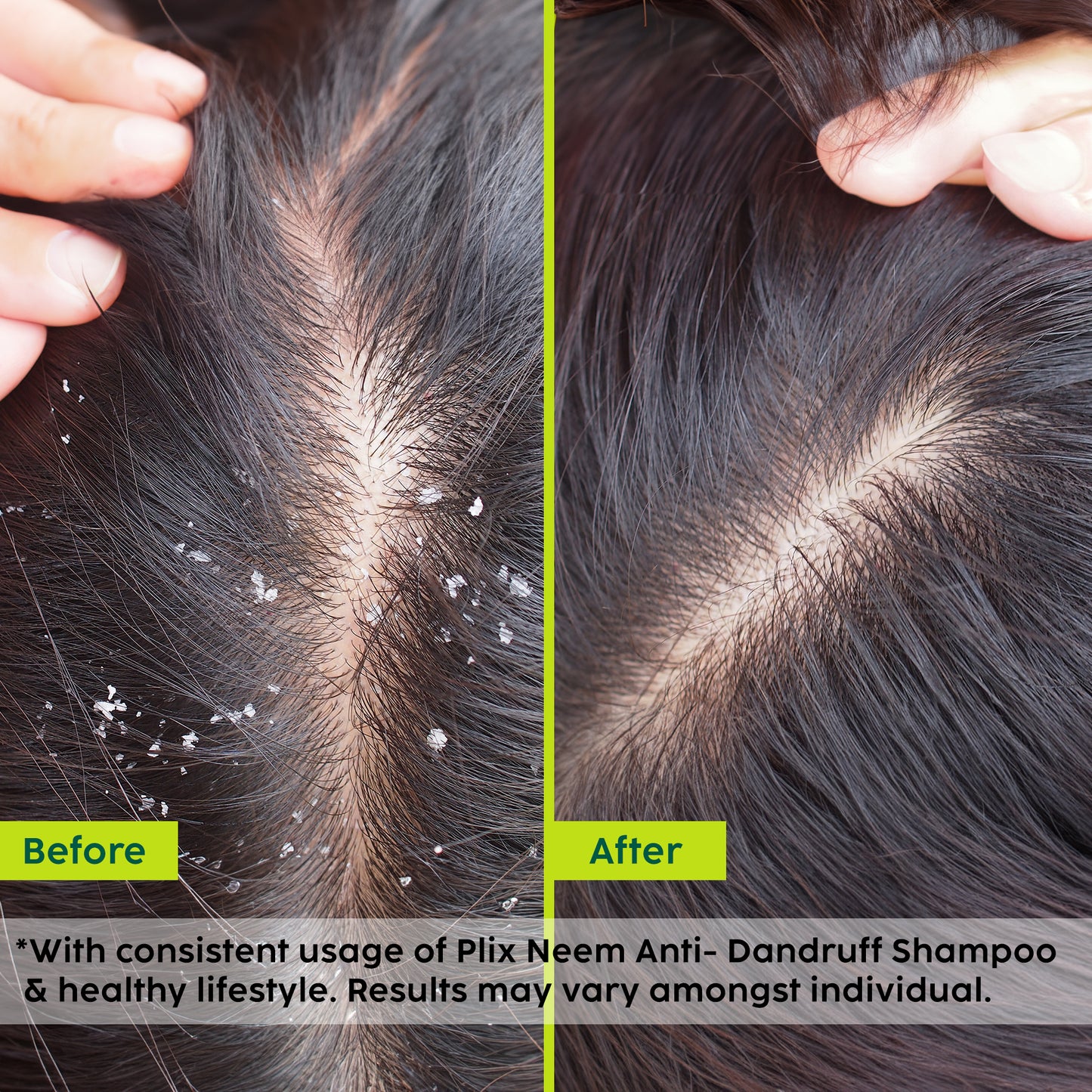 Neem Advanced Anti-Dandruff Conditioner